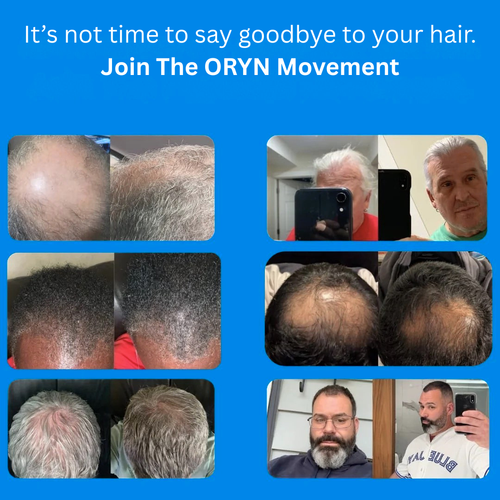 ORYN™ - Peptide Infusion Hair Regrowth System